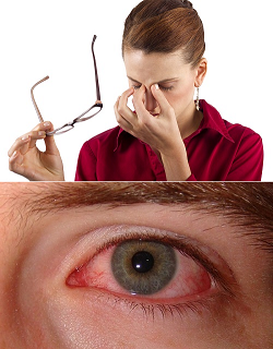Хирургическое лечение синдрома сухого глаза thumbnail