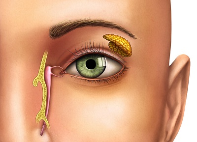 Хирургическое лечение синдрома сухого глаза